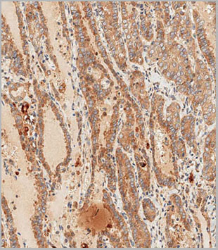 product-image-AAA28750_IHC4.jpg