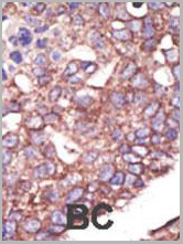 product-image-AAA28764_IHC5.jpg