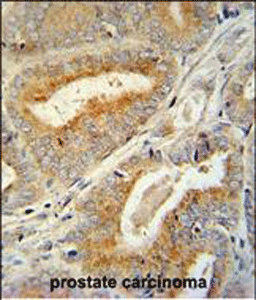 product-image-AAA28773_IHC6.jpg