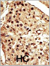 product-image-AAA28787_IHC2.jpg