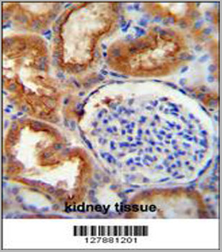 product-image-AAA28799_IHC2.jpg
