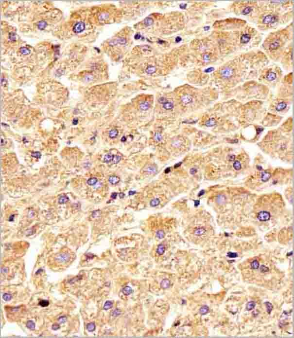 product-image-AAA28807_IHC2.jpg
