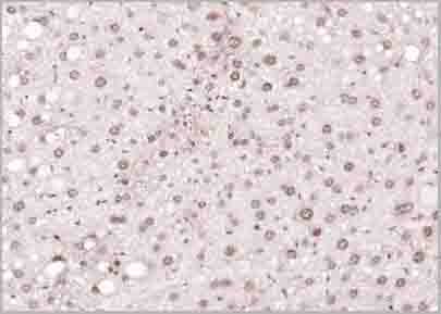 product-image-AAA28811_IHC7.jpg