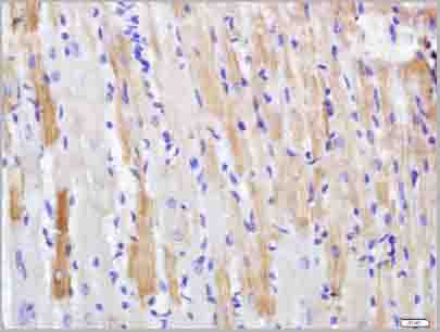 product-image-AAA28812_IHC2.jpg
