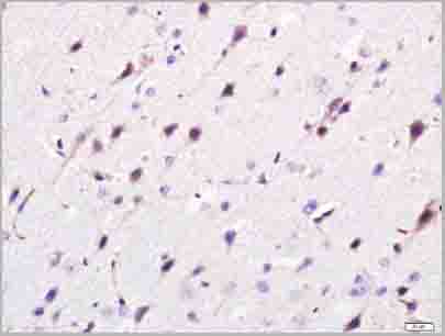 product-image-AAA28815_IHC3.jpg