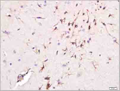 product-image-AAA28815_IHC4.jpg