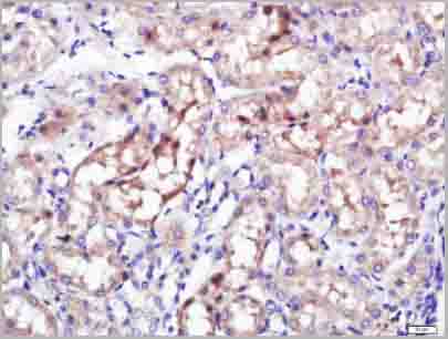 product-image-AAA28815_IHC5.jpg