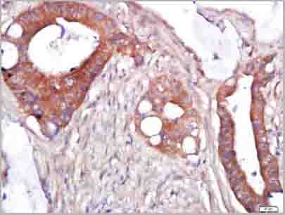 product-image-AAA28815_IHC7.jpg