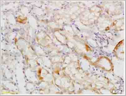 product-image-AAA28822_IHC.jpg