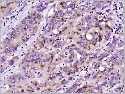 product-image-AAA28825_IHC3.jpg