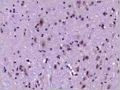 product-image-AAA28825_IHC5.jpg