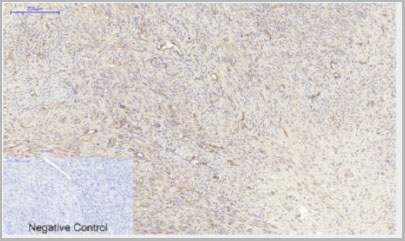 product-image-AAA29102_IHC7.jpg