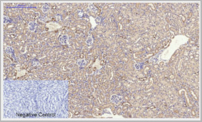 product-image-AAA29102_IHC8.jpg