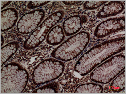 product-image-AAA29184_IHC3.jpg