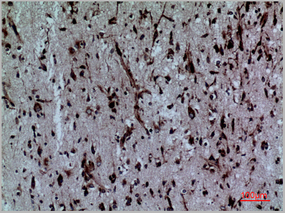 product-image-AAA29184_IHC6.jpg