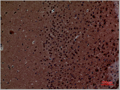 product-image-AAA29185_IHC5.jpg