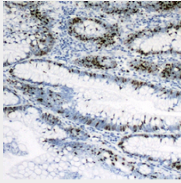 product-image-AAA292847_IHC.png