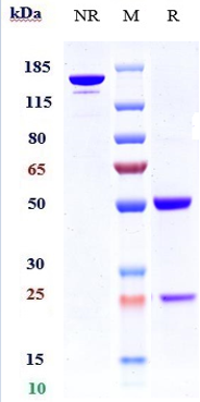 product-image-AAA29392_SDS_PAGE.jpg