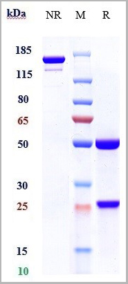 product-image-AAA29395_SDS_PAGE.jpg