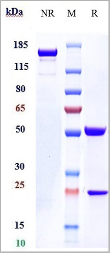 product-image-AAA29396_SDS_PAGE.jpg