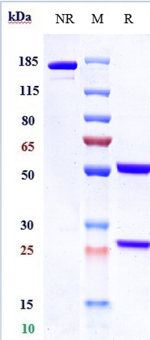 product-image-AAA29398_SDS_PAGE.jpg