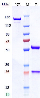 product-image-AAA29399_SDS_PAGE.jpg