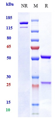 product-image-AAA29400_SDS_PAGE.jpg