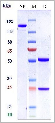 product-image-AAA29401_SDS_PAGE.jpg