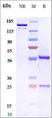 product-image-AAA29404_SDS_PAGE.jpg