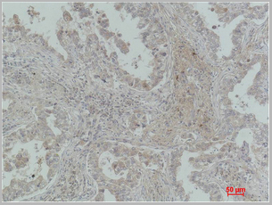 product-image-AAA29640_IHC2.jpg