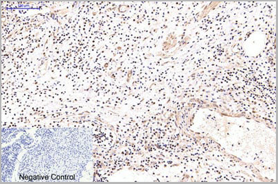 product-image-AAA29642_IHC5.jpg