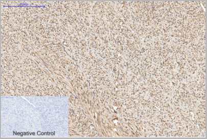 product-image-AAA29643_IHC6.jpg