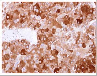 product-image-AAA29648_IHC2.jpg