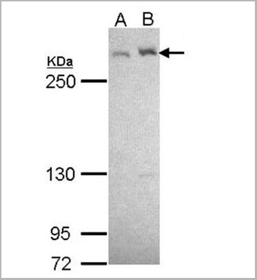 product-image-AAA29648_SDS_PAGE4.jpg