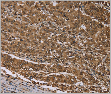 product-image-AAA29656_IHC.jpg
