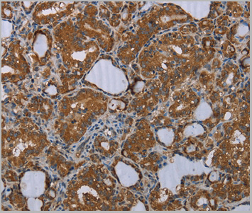 product-image-AAA29656_IHC2.jpg