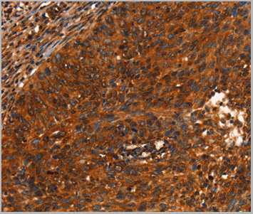 product-image-AAA29660_IHC2.jpg