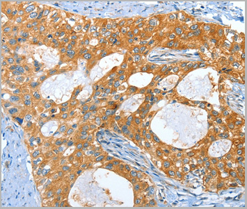 product-image-AAA29661_IHC.jpg