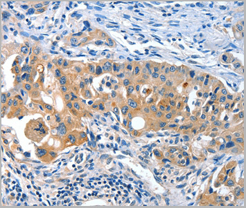 product-image-AAA29661_IHC2.jpg