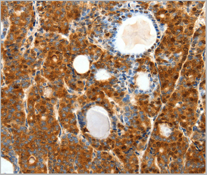 product-image-AAA29675_IHC2.jpg
