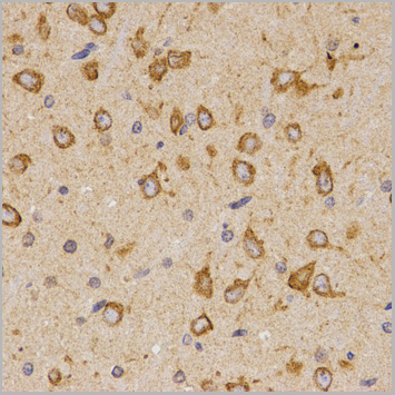 product-image-AAA29675_IHC3.jpg