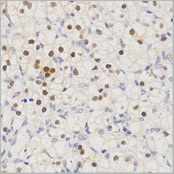 product-image-AAA29675_IHC5.jpg