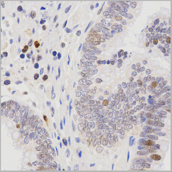 product-image-AAA29675_IHC6.jpg