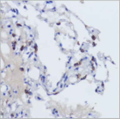 product-image-AAA29679_IHC2.jpg