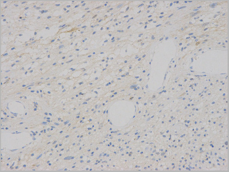 product-image-AAA29683_IHC3.jpg