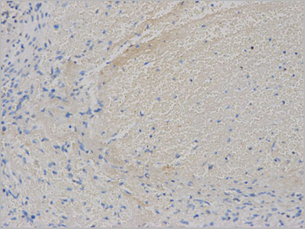 product-image-AAA29683_IHC4.jpg