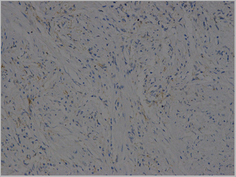 product-image-AAA29683_IHC6.jpg