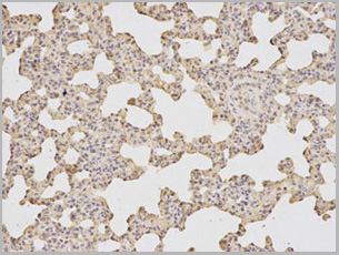 product-image-AAA29696_IHC2.jpg
