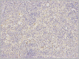 product-image-AAA29696_IHC3.jpg