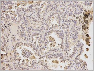 product-image-AAA29696_IHC4.jpg